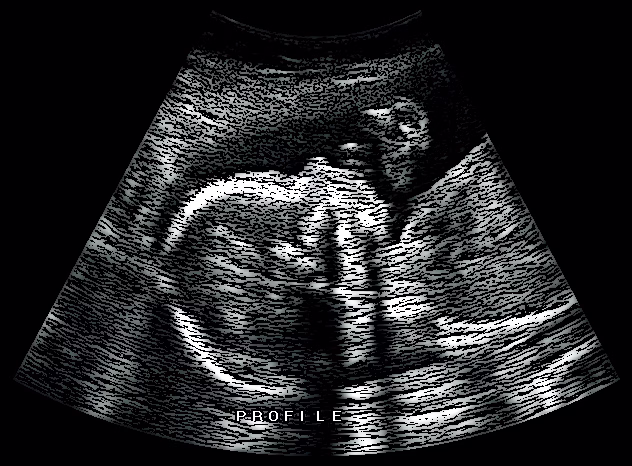 ultrasound jpg